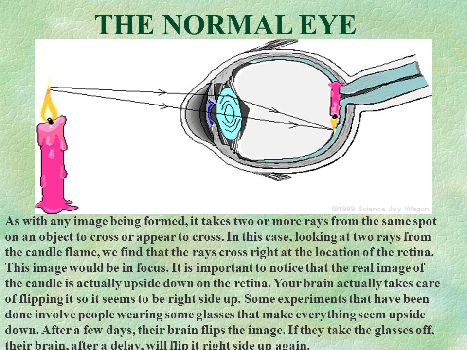THE NORMAL EYE As with any image being formed, it takes two or more rays from the same spot on an object to cross or appear to cross.