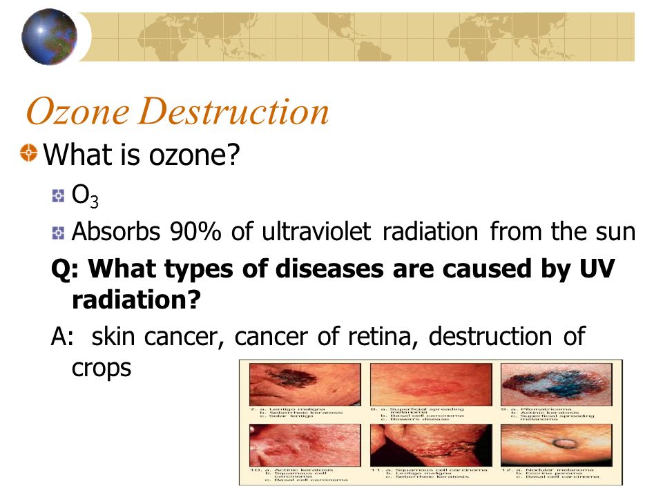 Ozone Destruction What is ozone.
