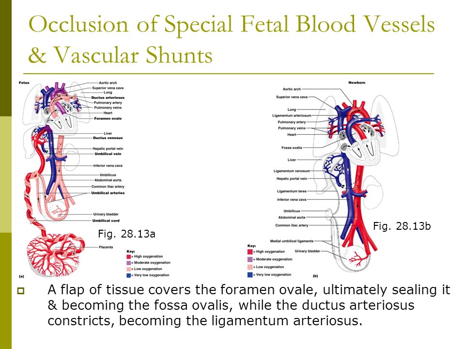 Occlusion of Special Fetal Blood Vessels & Vascular Shunts  A flap of tissue covers the foramen ovale, ultimately sealing it & becoming the fossa ovalis, while the ductus arteriosus constricts, becoming the ligamentum arteriosus.