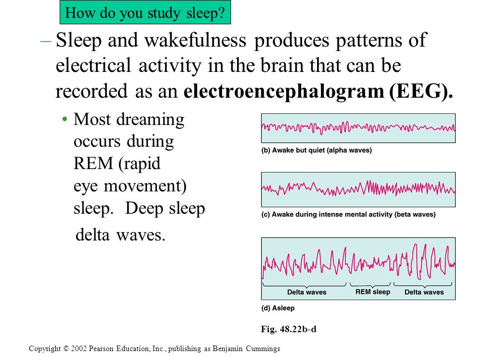 –Sleep and wakefulness produces patterns of electrical activity in the brain that can be recorded as an electroencephalogram (EEG).