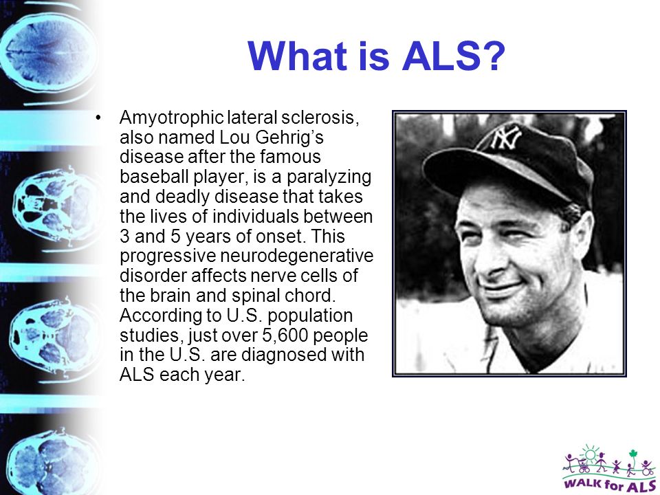 What is ALS.