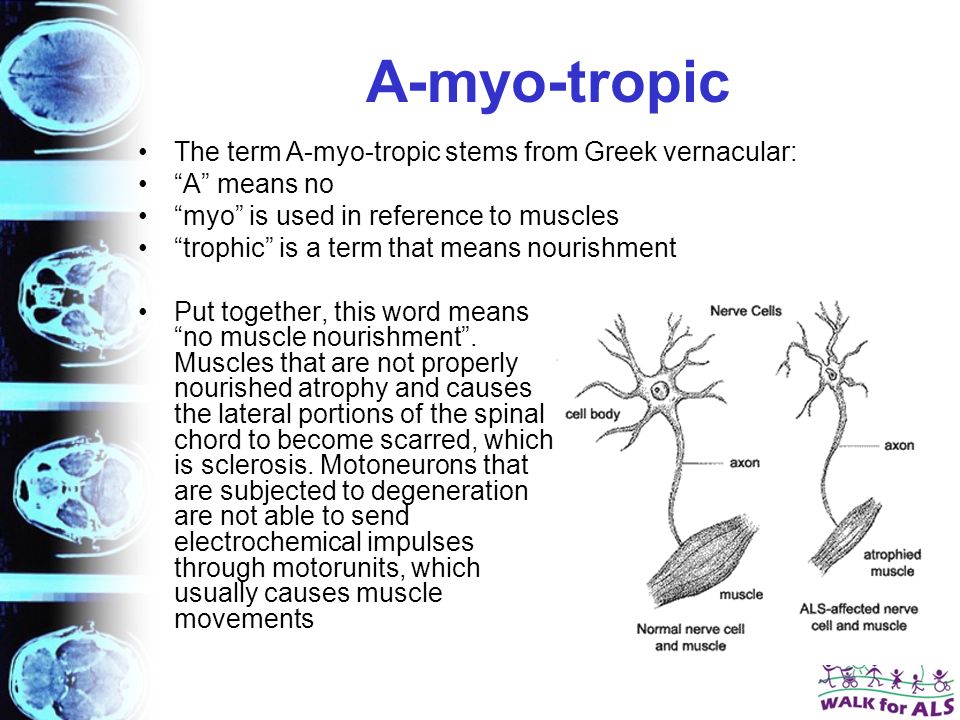 A-myo-tropic Put together, this word means no muscle nourishment .