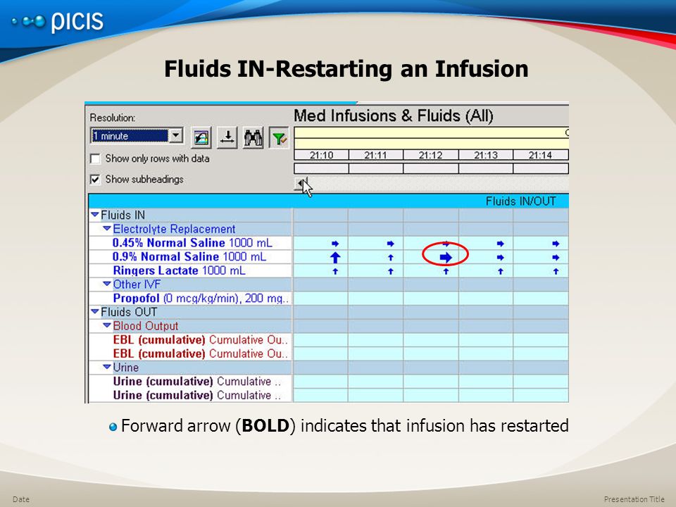 Presentation TitleDate Fluids IN-Restarting an Infusion Forward arrow (BOLD) indicates that infusion has restarted