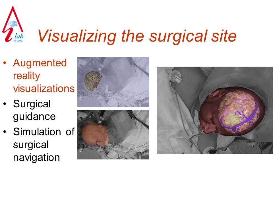 Visualizing the surgical site Augmented reality visualizations Surgical guidance Simulation of surgical navigation
