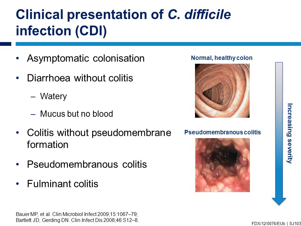 Introduction to clostridium difficile infection slide resource set fdx