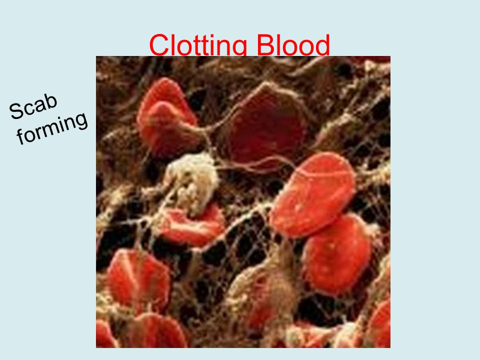Clotting Blood Scab forming