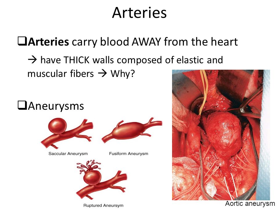 Arteries  Arteries carry blood AWAY from the heart  have THICK walls composed of elastic and muscular fibers  Why.