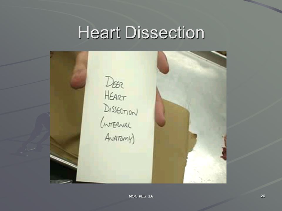 MSC PES 1A 20 Heart Dissection