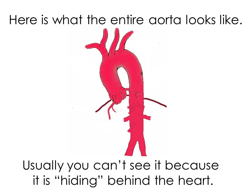 Here is what the entire aorta looks like.