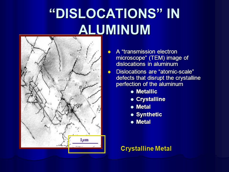 DISLOCATIONS IN ALUMINUM A transmission electron microscope (TEM) image of dislocations in aluminum A transmission electron microscope (TEM) image of dislocations in aluminum Dislocations are atomic-scale defects that disrupt the crystalline perfection of the aluminum Dislocations are atomic-scale defects that disrupt the crystalline perfection of the aluminum Metallic Crystalline Metal Synthetic Metal Crystalline Metal