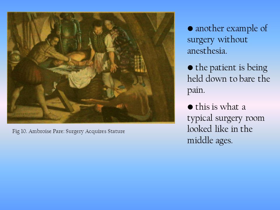 Fig 10. Ambroise Pare: Surgery Acquires Stature another example of surgery without anesthesia.