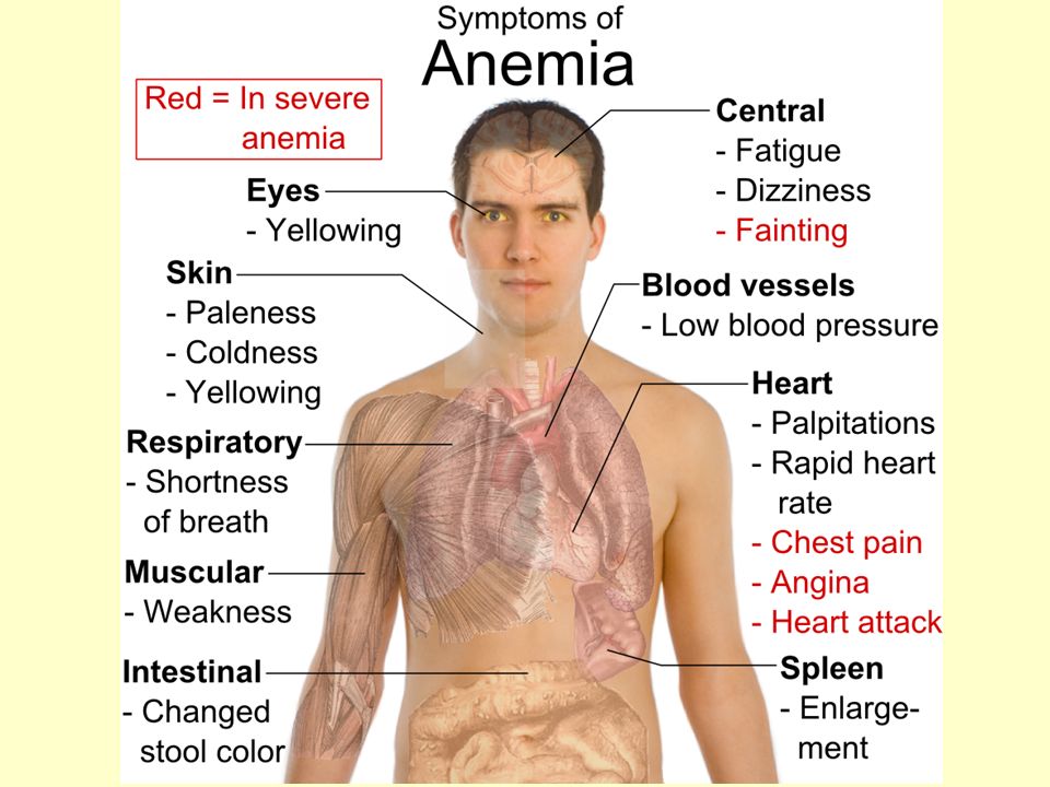 Подозрения на анемию