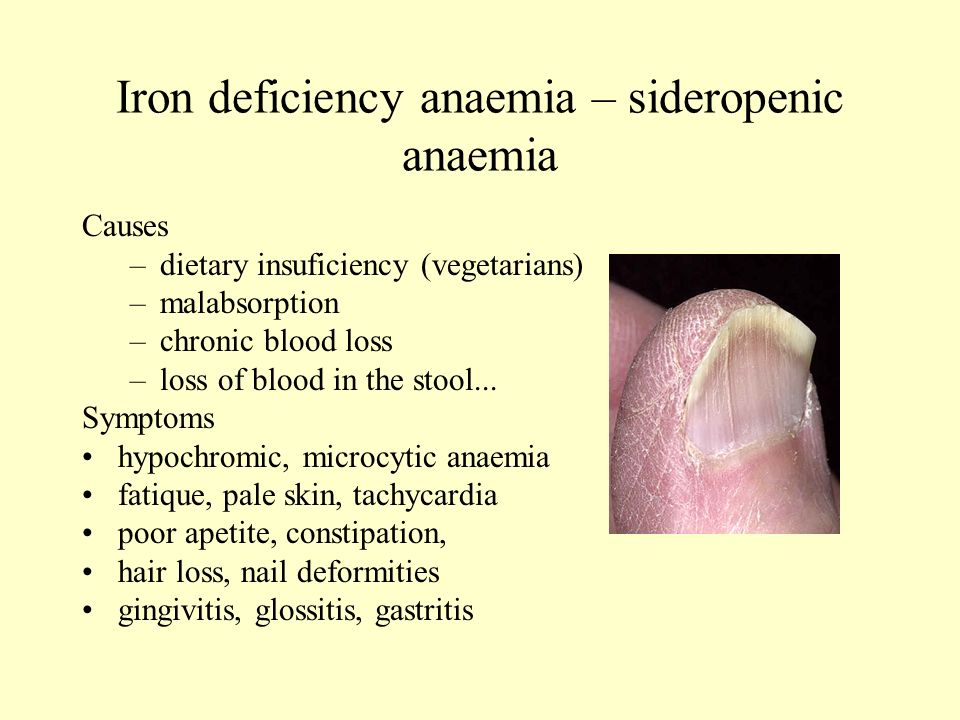 Se puede curar la anemia
