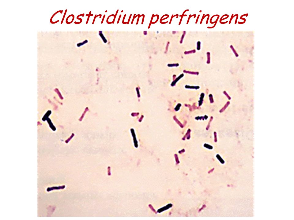 Clostridium - Microscopic appearance of different species. -  Differentiation between species according to biochemical reactions. - ppt  download