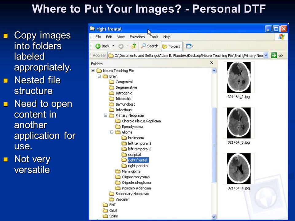 Where to Put Your Images. - Personal DTF Copy images into folders labeled appropriately.