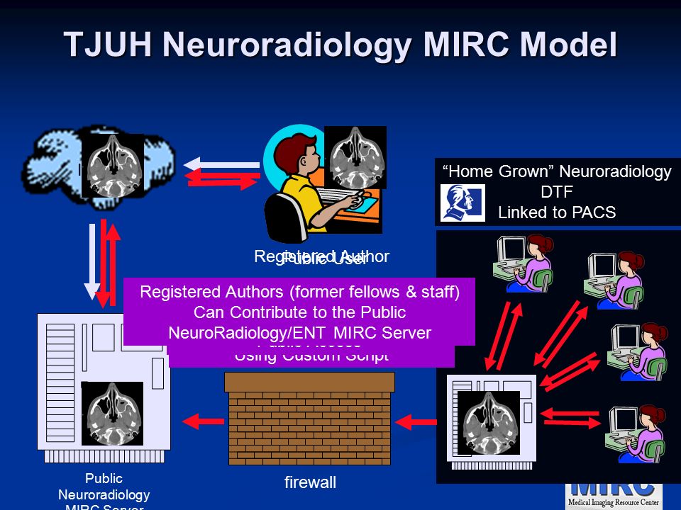 TJUH Neuroradiology MIRC Model Internet Public Neuroradiology MIRC Server firewall Home Grown Neuroradiology DTF Linked to PACS Public User Selected Neuro/ENT Cases Are Pushed Out to Public NeuroRadiology MIRC Server Using Custom Script Cases on NeuroRadiology/ENT MIRC Server are Available for Public Access Registered Author Registered Authors (former fellows & staff) Can Contribute to the Public NeuroRadiology/ENT MIRC Server