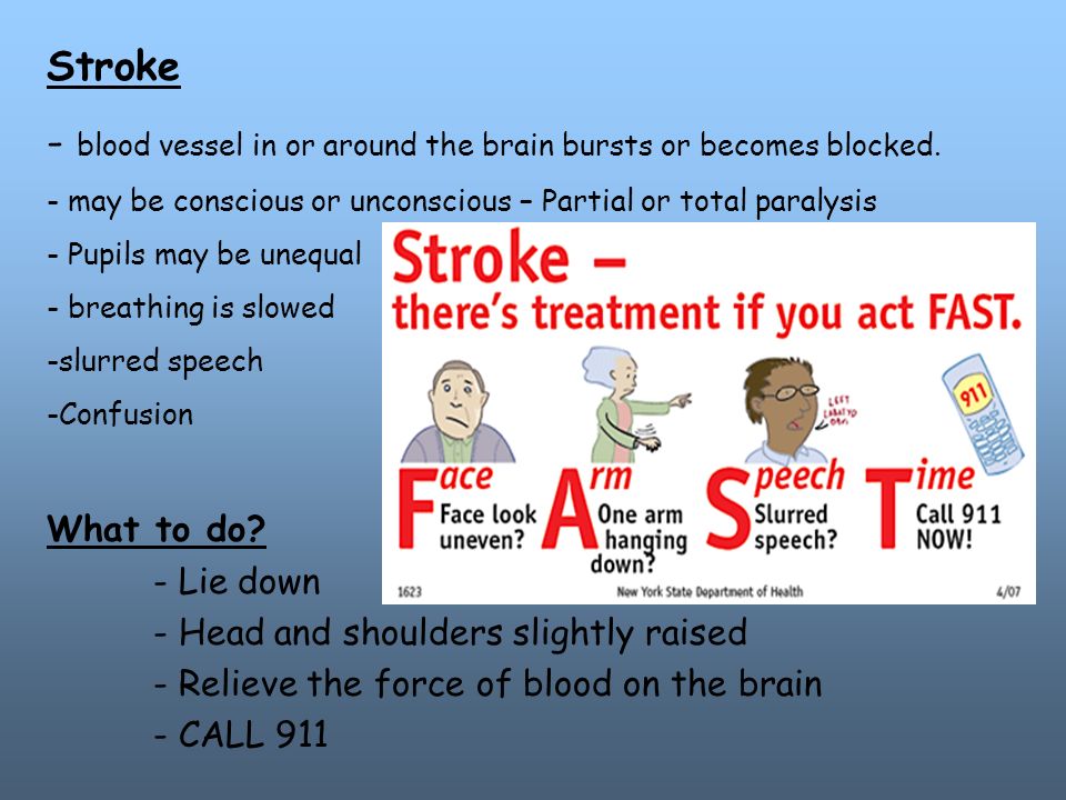 Stroke - blood vessel in or around the brain bursts or becomes blocked.