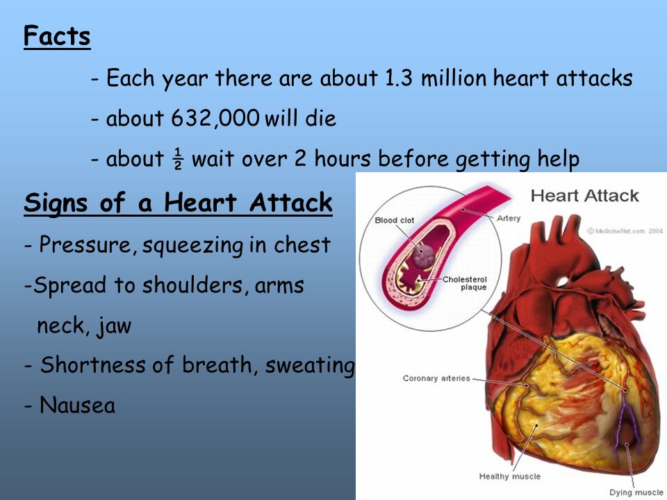Facts - Each year there are about 1.3 million heart attacks - about 632,000 will die - about ½ wait over 2 hours before getting help Signs of a Heart Attack - Pressure, squeezing in chest -Spread to shoulders, arms neck, jaw - Shortness of breath, sweating - Nausea