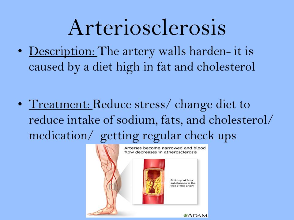 Arteriosclerosis Description: The artery walls harden- it is caused by a diet high in fat and cholesterol Treatment: Reduce stress/ change diet to reduce intake of sodium, fats, and cholesterol/ medication/ getting regular check ups