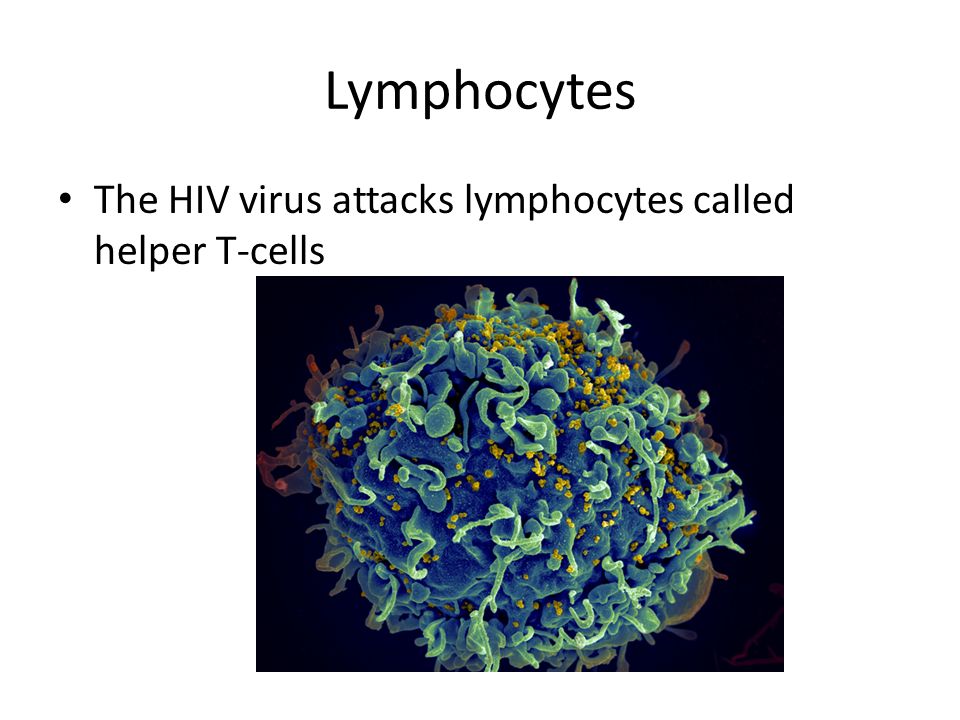 Lymphocytes The HIV virus attacks lymphocytes called helper T-cells