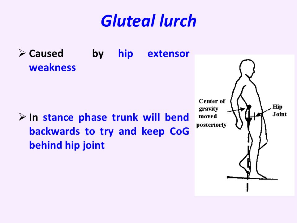 Gluteal lurch  Caused by hip extensor weakness  In stance phase trunk will bend backwards to try and keep CoG behind hip joint