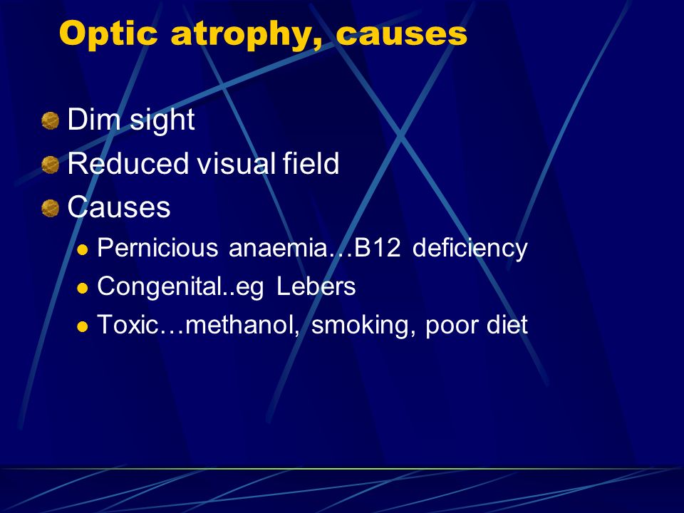 Optic atrophy, causes Dim sight Reduced visual field Causes Pernicious anaemia…B12 deficiency Congenital..eg Lebers Toxic…methanol, smoking, poor diet