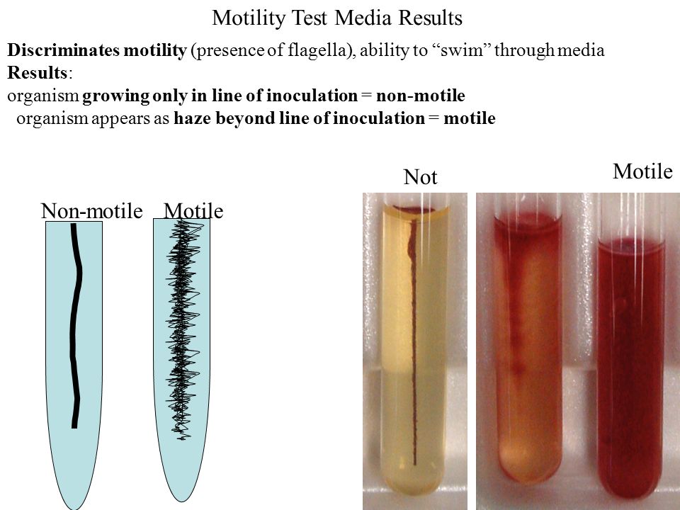 Lab 7 Goals and Objectives: Read the results: Gather all plates and tubes  so we can discuss results together: ***Do NOT shake the FTM tubes!!!***  Your. - ppt download