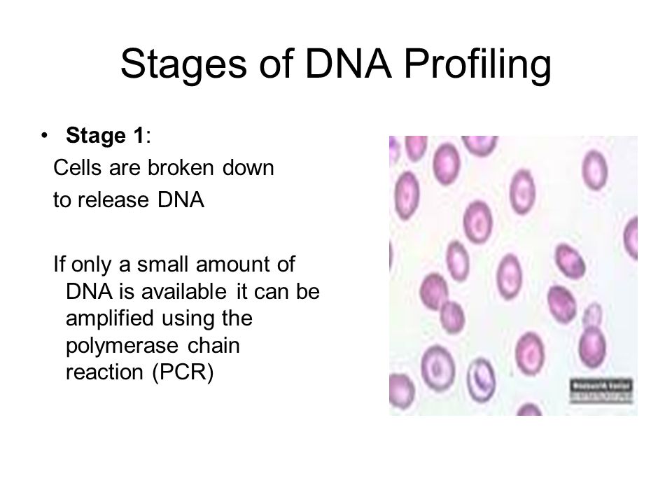 Stages of DNA Profiling Stage 1: Cells are broken down to release DNA If only a small amount of DNA is available it can be amplified using the polymerase chain reaction (PCR)