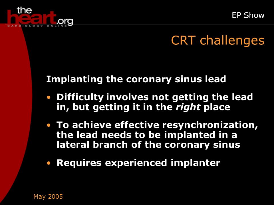 May 2005 EP Show CRT challenges Implanting the coronary sinus lead Difficulty involves not getting the lead in, but getting it in the right place To achieve effective resynchronization, the lead needs to be implanted in a lateral branch of the coronary sinus Requires experienced implanter