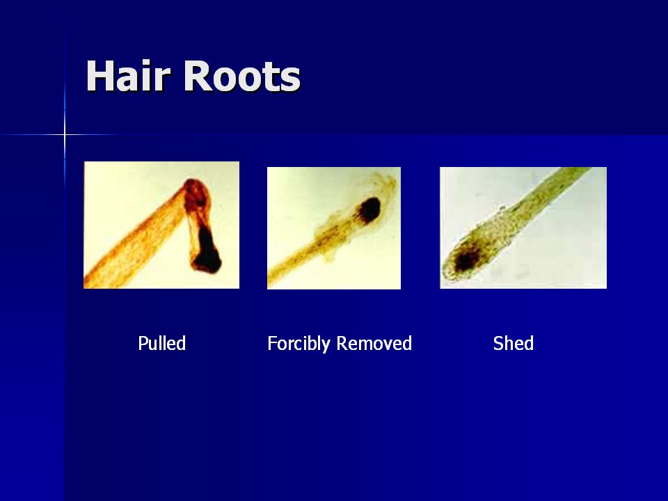 ANIMAL HAIR Comparison with Human Hair. ANIMAL HAIRS Animal hairs are  classified into the following three basic types. Guard hairs that form the  outer. - ppt download