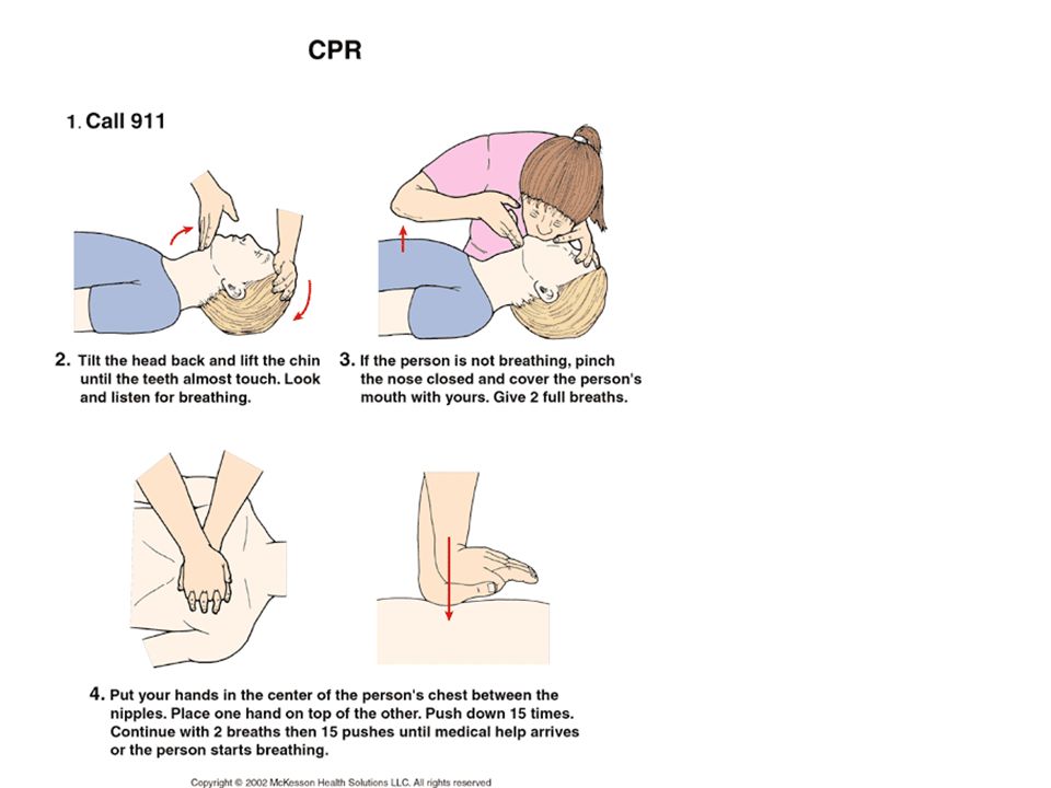 CPR. CPR монитор. How to perform CPR. CPR инструктаж.