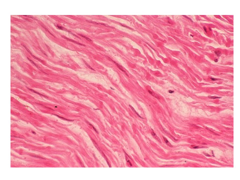 Гладкая мышечная ткань в дерме. Гладкая мышечная ткань гистология. Гладкая мышечная ткань гистология препарат. Гладкая мышечная ткань срез стенки мочевого пузыря. Гладкая мышечная ткань срез тонкой кишки.