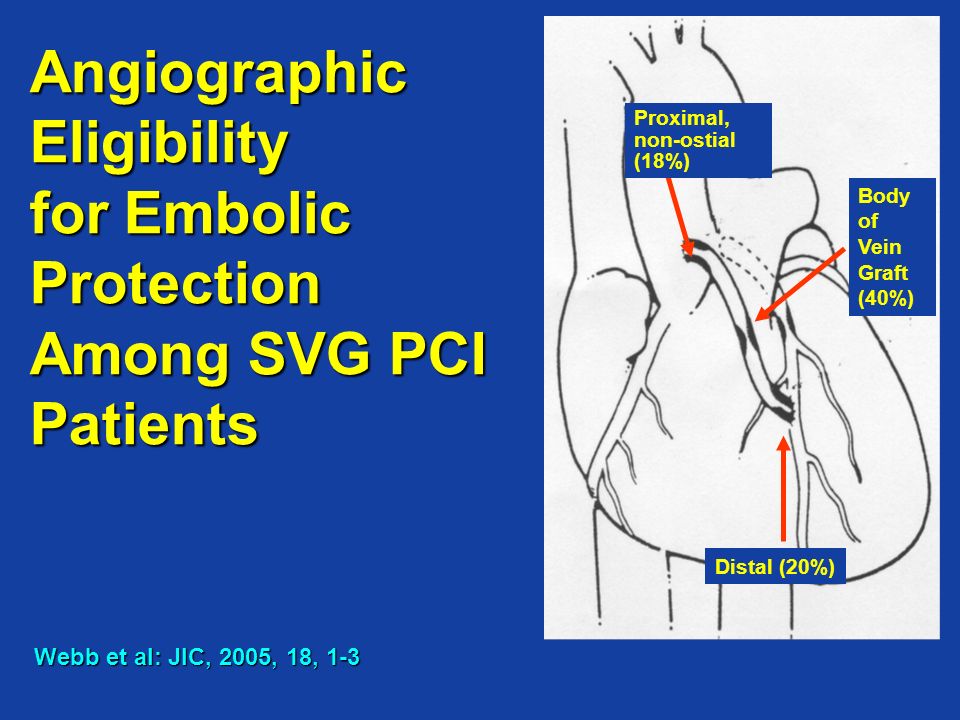 Webb et al: JIC, 2005, 18, 1-3 Angiographic Eligibility for Embolic Protection Among SVG PCI Patients Distal (20%) Proximal, non-ostial (18%) Body of Vein Graft (40%)