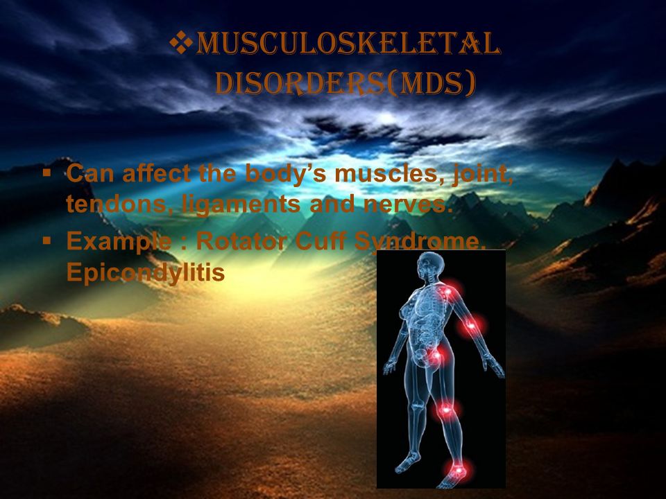  Musculoskeletal disorders(mds)  Can affect the body’s muscles, joint, tendons, ligaments and nerves.
