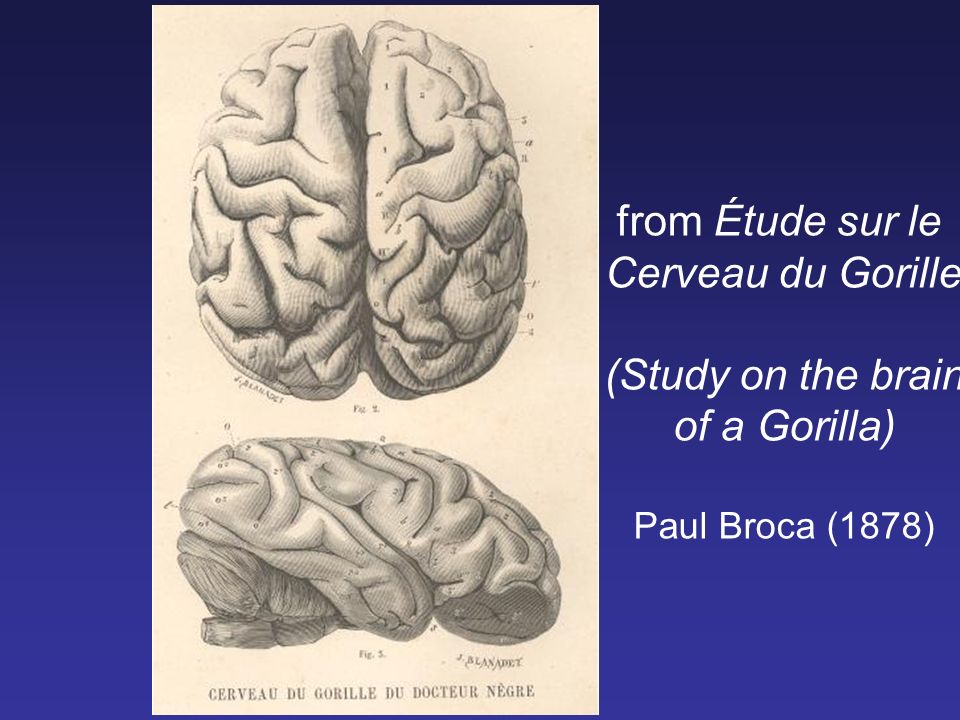 Image result for images of Paul Broca and Sir Galton