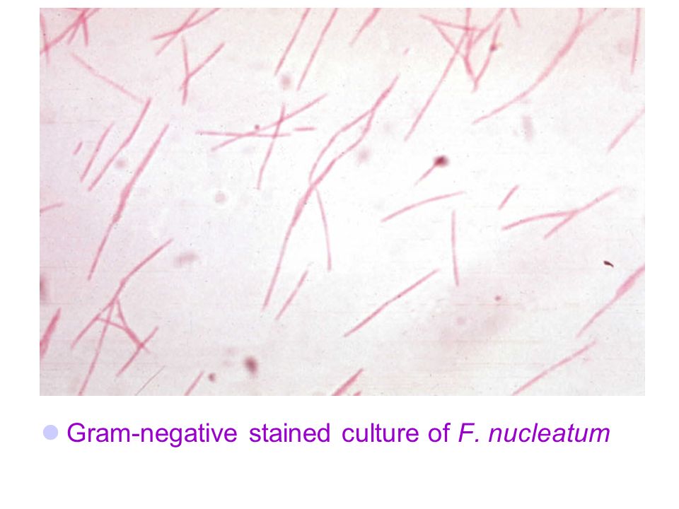 Gram-negative stained culture of F. nucleatum
