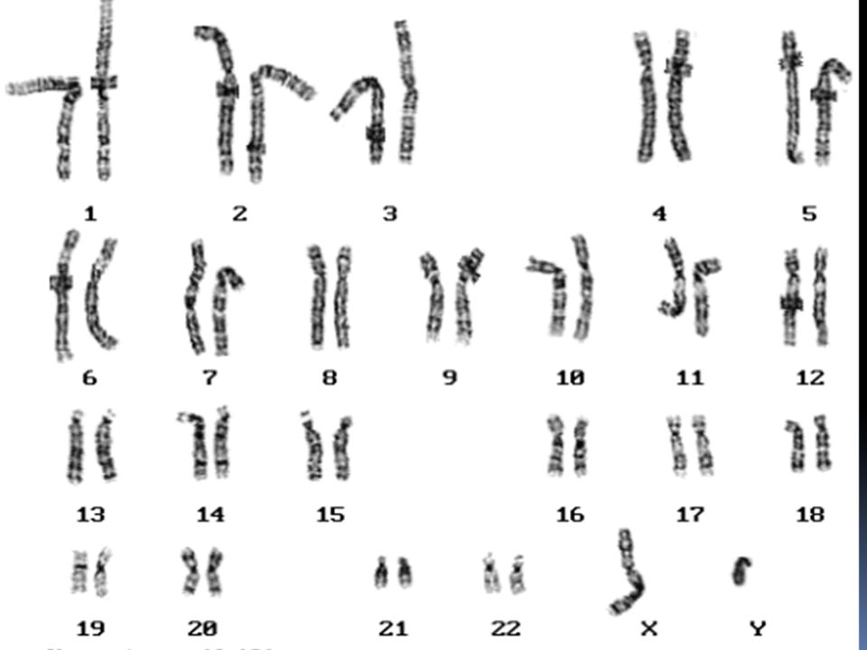 Парные одинаковые хромосомы