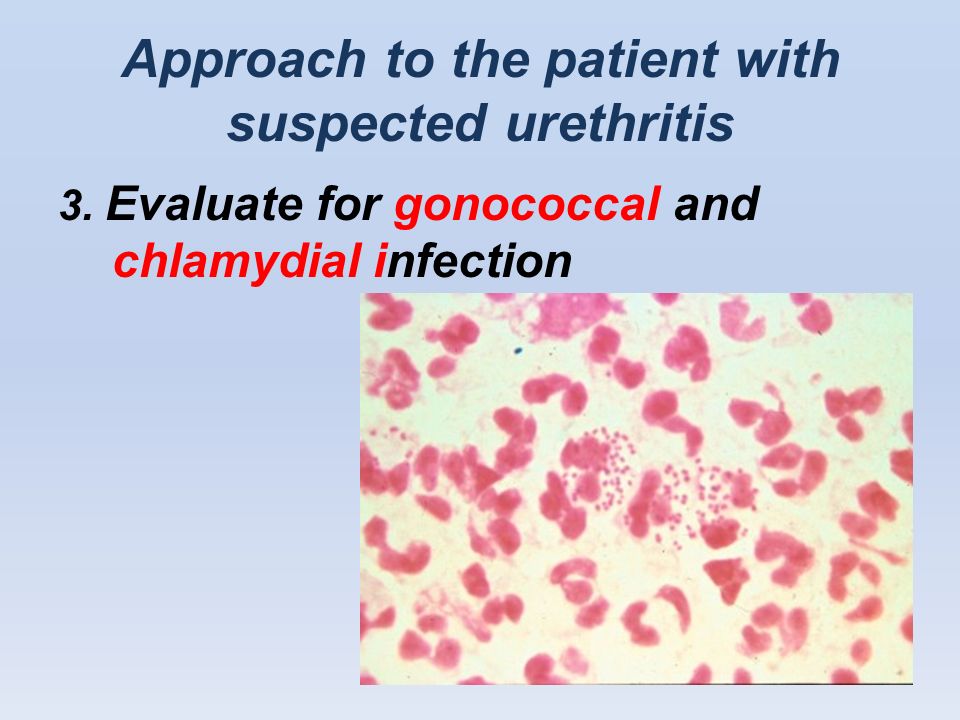 Approach to the patient with suspected urethritis 3.
