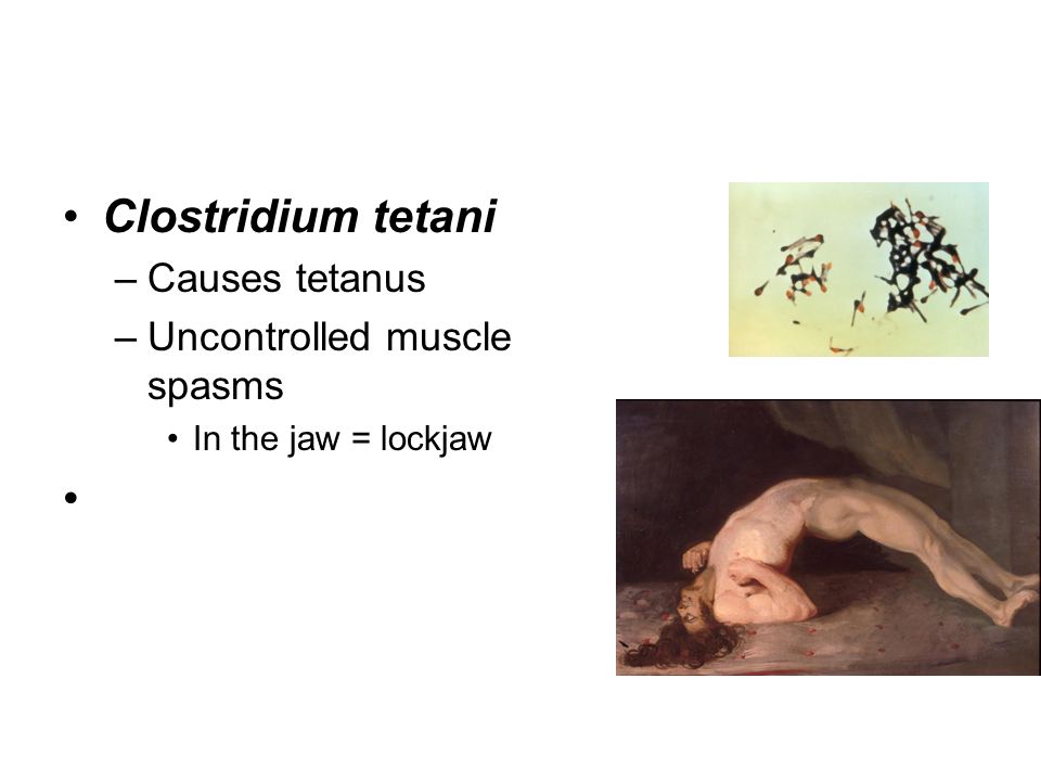 Clostridium tetani –Causes tetanus –Uncontrolled muscle spasms In the jaw = lockjaw