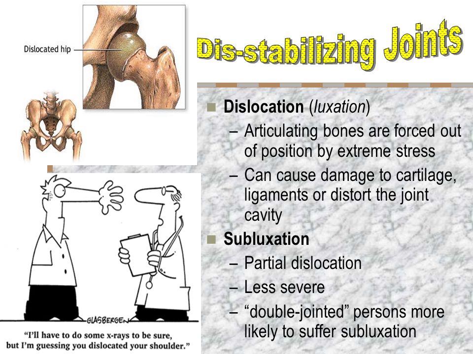 Dislocation ( luxation ) –Articulating bones are forced out of position by extreme stress –Can cause damage to cartilage, ligaments or distort the joint cavity Subluxation –Partial dislocation –Less severe – double-jointed persons more likely to suffer subluxation