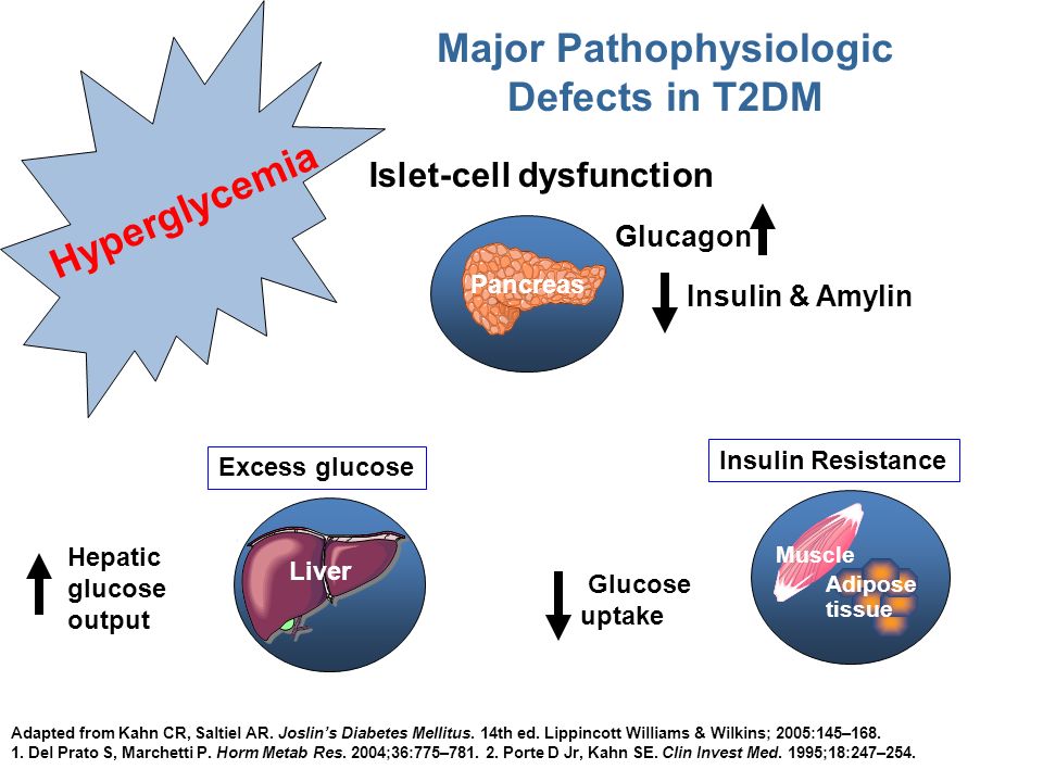 joslins diabetes mellitus 14th edition