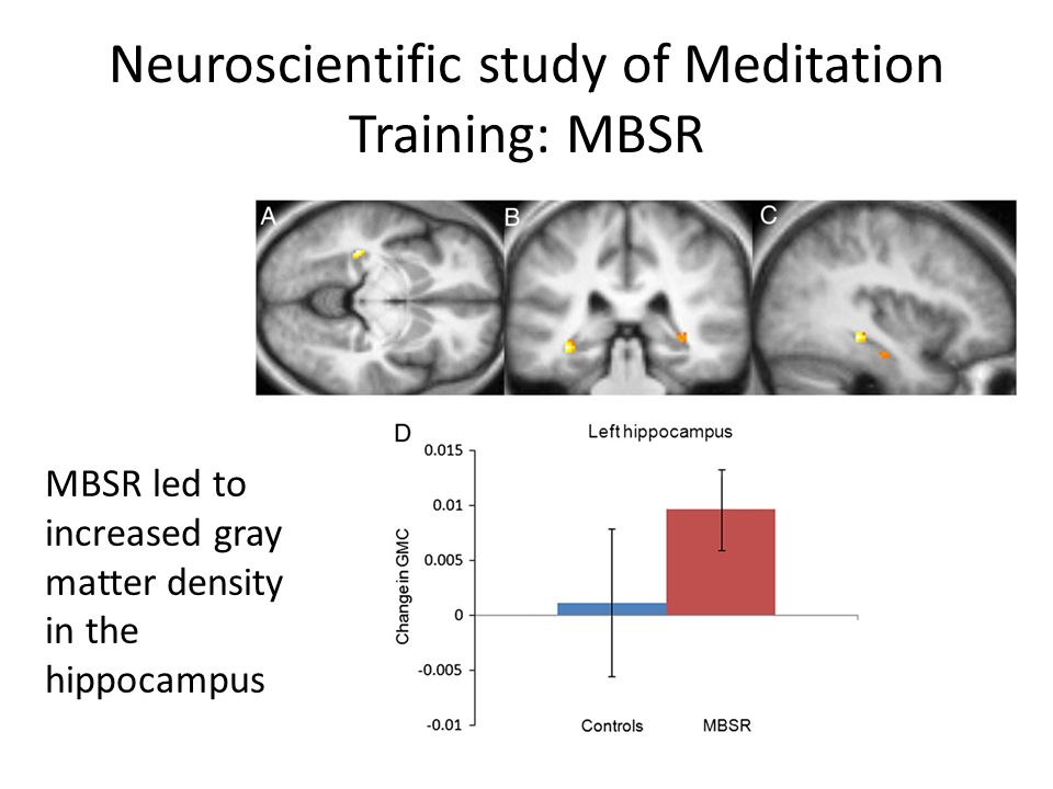 Gray Matter Density Increases During >> Contemplative Neuroscience Ii Emiliana Simon Thomas Ppt Download Gray Matter Density Increases During >> Contemplative Neuroscience Ii Emiliana Simon Thomas Ppt Download