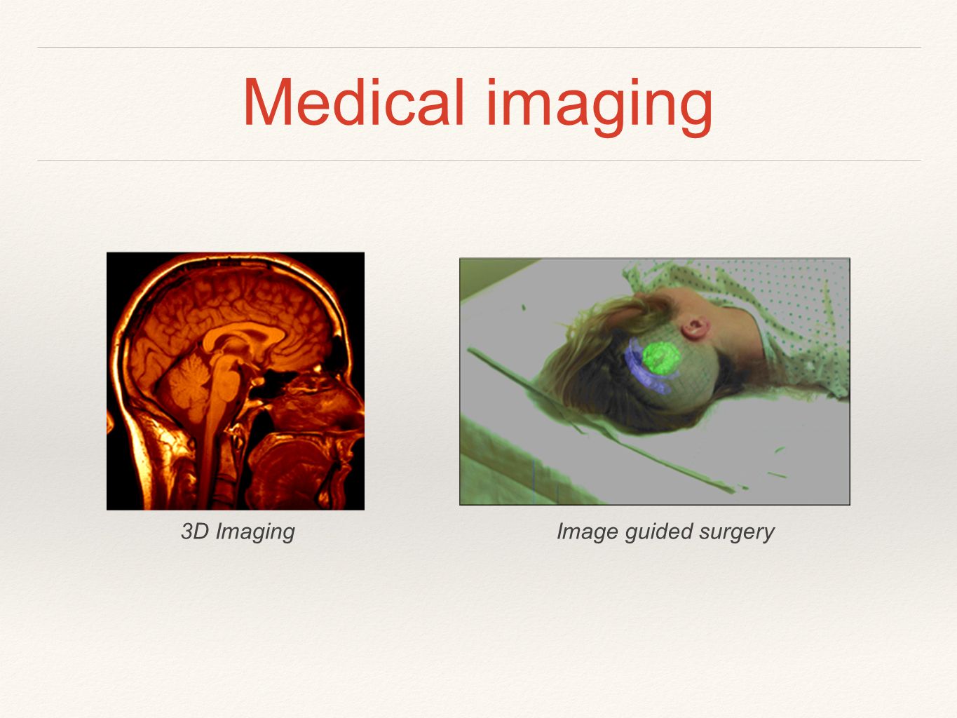 Medical imaging Image guided surgery3D Imaging