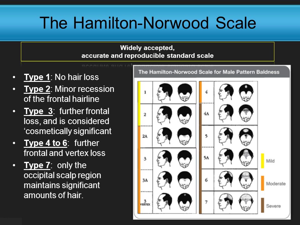 The Hamilton-Norwood Scale Type 1: No hair loss Type 2: Minor recession of the frontal hairline Type 3: further frontal loss, and is considered ‘cosmetically significant Type 4 to 6: further frontal and vertex loss Type 7: only the occipital scalp region maintains significant amounts of hair.