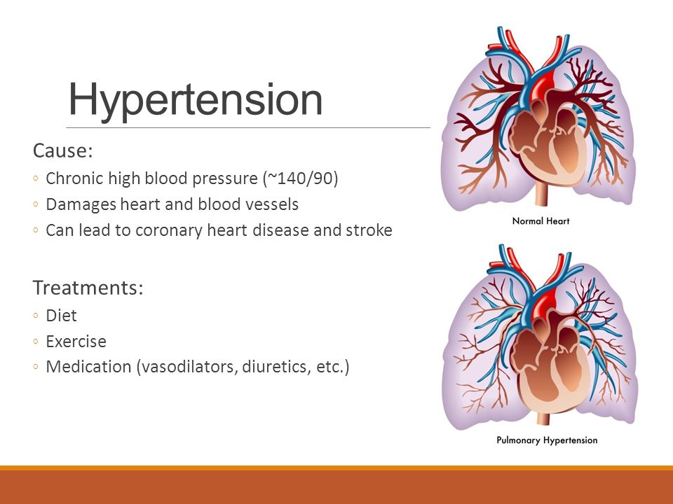 Hypertension Cause: ◦Chronic high blood pressure (~140/90) ◦Damages heart and blood vessels ◦Can lead to coronary heart disease and stroke Treatments: ◦Diet ◦Exercise ◦Medication (vasodilators, diuretics, etc.)