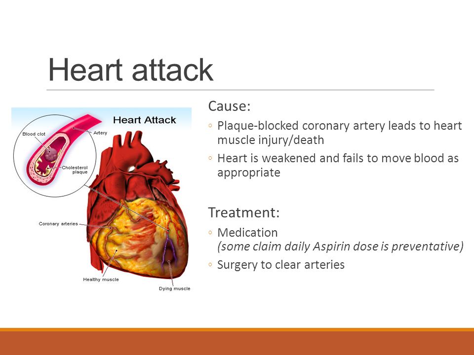 Heart attack Cause: ◦Plaque-blocked coronary artery leads to heart muscle injury/death ◦Heart is weakened and fails to move blood as appropriate Treatment: ◦Medication (some claim daily Aspirin dose is preventative) ◦Surgery to clear arteries