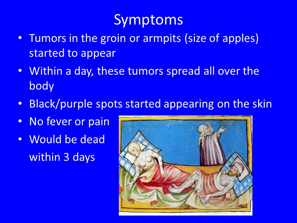 Symptoms Tumors in the groin or armpits (size of apples) started to appear Within a day, these tumors spread all over the body Black/purple spots started appearing on the skin No fever or pain Would be dead within 3 days