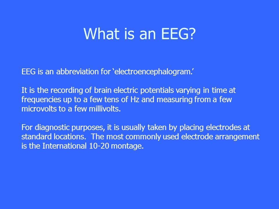 Microvolts to volts