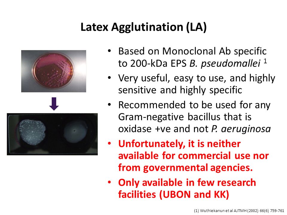 Latex Agglutination (LA) Based on Monoclonal Ab specific to 200-kDa EPS B.