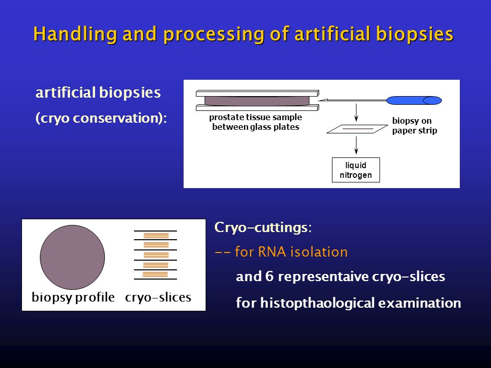 Handling and processing of artificial biopsies liquid nitrogen prostate tissue sample between glass plates biopsy on paper strip artificial biopsies (cryo conservation): Cryo-cuttings: -- for RNA isolation and 6 representaive cryo-slices for histopthaological examination biopsy profilecryo-slices